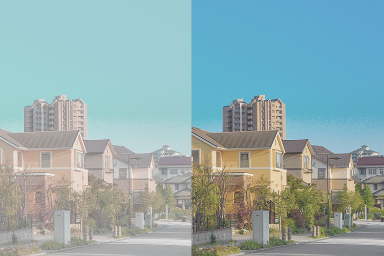 白内障のイメージ写真