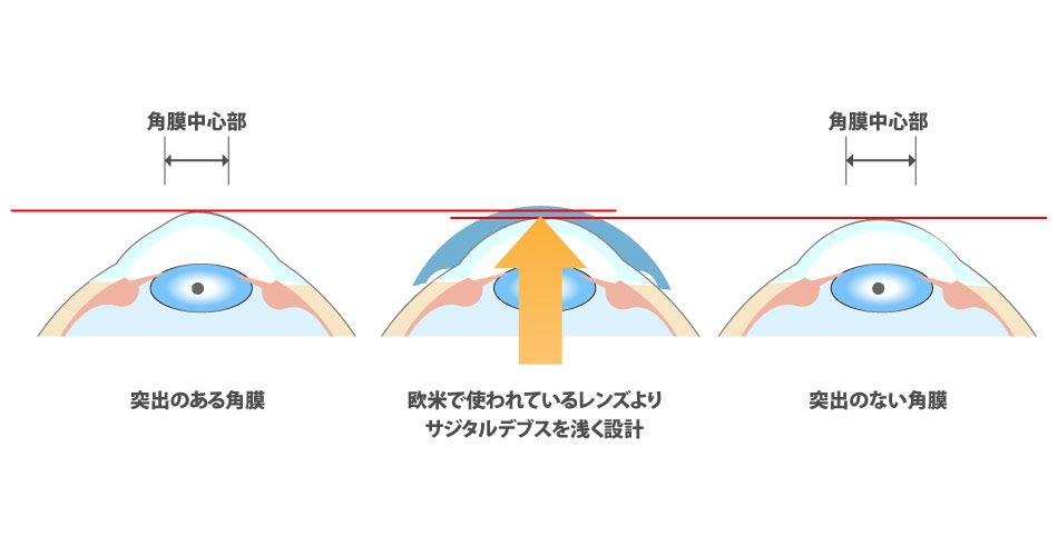 ブレスオーコレクト®のイメージ写真